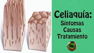 CELIAQUÍA Causas síntomas tratamiento y posibles complicaciones [upl. by Neeloj680]