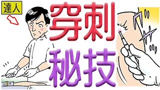 穿刺の秘技とは！？この人は実在します！【６０秒で学べる透析雑学】12話…透析バンザイの弟 [upl. by Sowell]