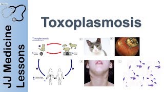 Toxoplasmosis  Acquired vs Congenital  Signs Symptoms Diagnosis and Treatment [upl. by Shurwood43]