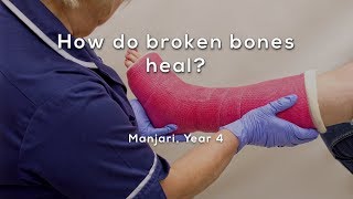 How do broken bones heal [upl. by Azyl]