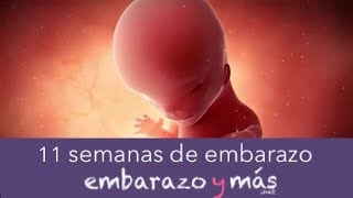 11 semanas de embarazo  Tercer mes  EMBARAZOYMAS [upl. by Qifahs852]