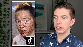 Specialist Reacts to Skin Care TikTok FAILS [upl. by Schiff824]