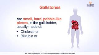 Cholecystitis Nursing NCLEX Pathophysiology Symptoms TTube amp Cholecystostomy [upl. by Asseram]