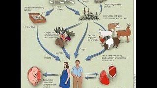 Congenital Toxoplasmosis [upl. by Emelita]