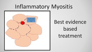 Myositis Patient Experience [upl. by Aicilic]