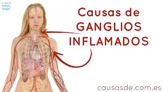 Causas de ganglios inflamados [upl. by Yzus299]