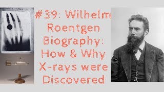 Wilhelm Roentgen Biography How amp Why Xrays were Discovered [upl. by Nylaret556]