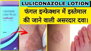 Luliconazole Lotion 1 wv [upl. by Nigam295]