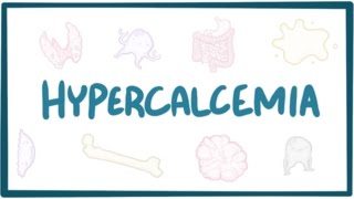 Hypercalcemia  causes symptoms diagnosis treatment pathology [upl. by Chilcote]