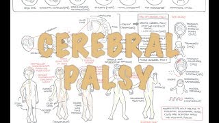 Cerebral Palsy  DETAILED Overview [upl. by Gayleen]