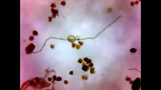 Isolation of arbuscular mycorrhizal spores [upl. by Newbold]