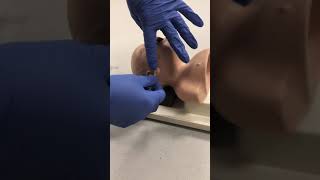 NasoPharyngeal Suctioning [upl. by Seroled]