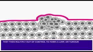 How Cancer Develops amp Mutation [upl. by Garrick]