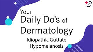 Idiopathic Guttate Hypomelanosis  Daily Dos of Dermatology [upl. by Joy]