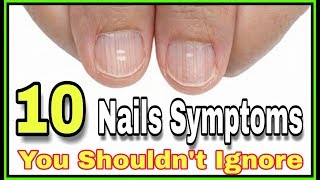 What Ridges In Finger And Toenails Mean For Your Health [upl. by Minnie]