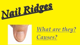 SPLIT NAILS  Causes Prevention amp Treatment  DrTina Ramachander  Doctors Circle [upl. by Jody481]