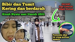 GANGGUAN KESEHATAN SAAT UMROH 2022  Perlengkapan wajib dimiliki saat umrohhaji [upl. by Atnad]