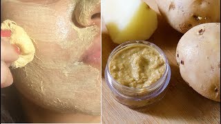 Apply Potato Face Pack Daily to Remove Dark Spots Hyperpigmentation Skin Whitening [upl. by Erihppas]