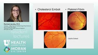 Retinal Vascular Disease [upl. by Afinom]