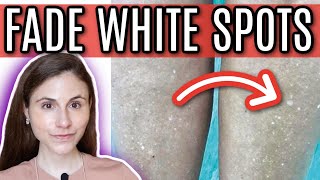 How to FADE WHITE SPOTS from SUN DAMAGE  Dr Dray [upl. by Sadonia301]