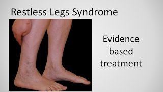 Restless Leg Syndrome evidence based treatment [upl. by Anni]