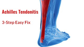 Achilles Tendonitis Fix in 3 Simple Steps [upl. by Assile]