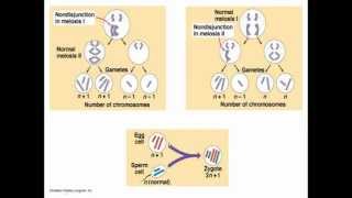 Chromosomal abnormalities [upl. by Adiana]