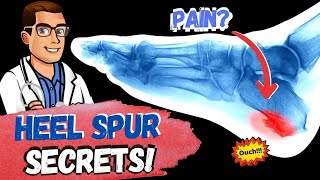 BEST Heel Spur Treatment Heel Spur Removal Stretches amp Massage [upl. by Sopher251]