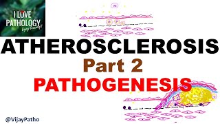 ATHEROSCLEROSIS  Part 2 Pathogenesis [upl. by Wrench]