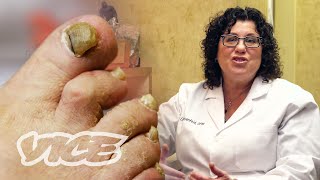 Meet a Toenail Fungus Expert [upl. by Ahsiema]