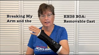 Broken Arm Wrist EXOS BOA Removable Cast — Helpful Tips [upl. by Cini]