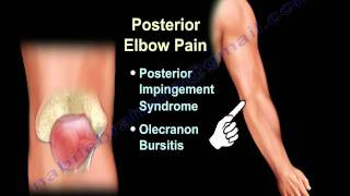 ELBOW PAIN  COMMON CAUSES  Everything You Need To Know  Dr Nabil Ebraheim [upl. by Marijo]