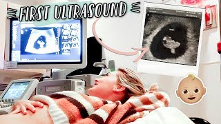 FIRST PREGNANCY ULTRASOUND  HEARING BABYS HEARTBEAT [upl. by Artened]