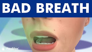 Bad Breath  Halitosis causes and treatment © [upl. by Parke]