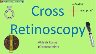 Cross Retinoscopy  Retinoscopy Procedure [upl. by Nara]