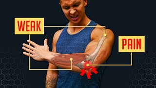 How To Fix Elbow Pain BULLETPROOF YOUR ELBOWS [upl. by Sarge]