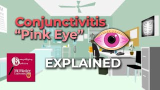 Common eye diseases explained [upl. by Muller]