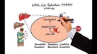 Cholesterol Treatment Guidelines and Clinical Applications in ACS Patients [upl. by Pazice]