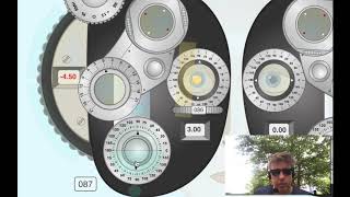 Retinoscopy with Refracting Instrument Plus cylinder [upl. by Htebsle]