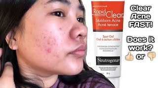 Neutrogena Rapid Clear Stubborn Acne Spot Gel Does it work [upl. by Zimmerman]