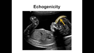 Introduction to Ultrasound  01  Fundamentals [upl. by Hoeve]