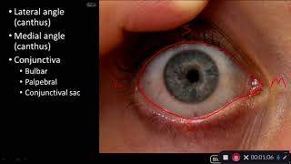 Eye Diseases  3 Common Eye Conditions [upl. by Janus]