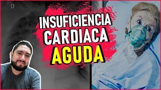 INSUFICIENCIA CARDIACA AGUDAABORDAJE EMERGENTE BY DR ZAMARRÓN [upl. by Nellahs]