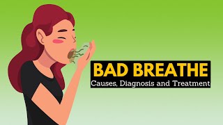 Bad Breath halitosis Causes Sign and Symptoms Diagnosis and Treatment [upl. by Anirdna735]