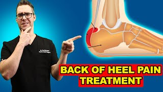 Retrocalcaneal Heel BURSITIS Treatment Heel Pain Exercises amp Massage [upl. by Hashum882]