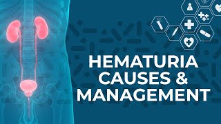 What are the Most Common Causes of Hematuria Blood in Urine [upl. by Aikemit]