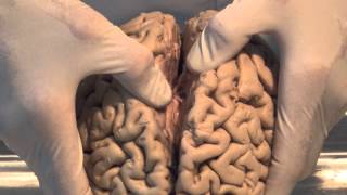 Introduction Neuroanatomy Video Lab  Brain Dissections [upl. by Keheley]