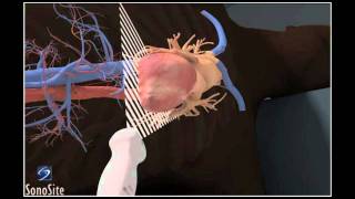 How To Apical 4Chamber View Echocardiography 3D Video [upl. by Eidoj12]