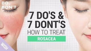 14 Tips for Rosacea That Really Work  Effective Skin Care Tips for Rosacea  Do amp Dont [upl. by Ijan]