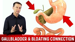 Gallbladder amp Bloating Connection Part 1 – DrBerg Bloated Stomach amp Gallbladder Function [upl. by Deana931]